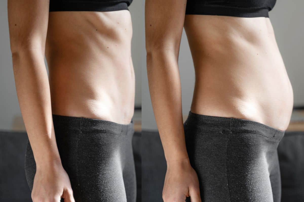 How long does diastasis recti take to improve Leicestershire?