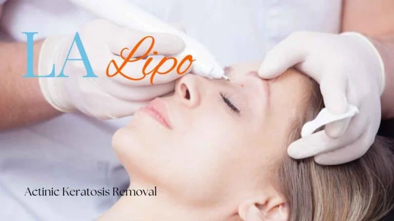 Woman receiving Actinic Keratosis Removal Treatment Leicestershire