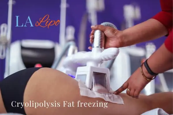 women getting fat freezing Leicestershire