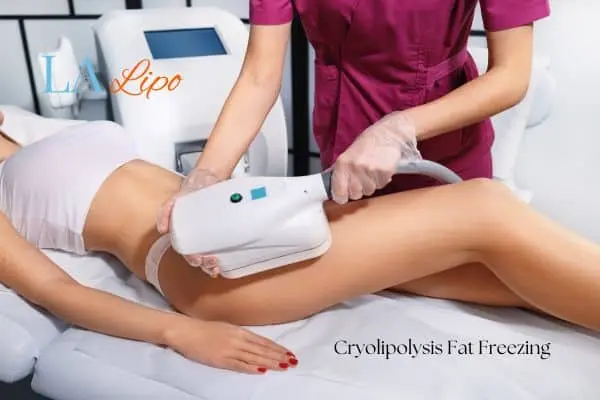 Woman receiving coolsculpting Leicestershire treatment on her thighs