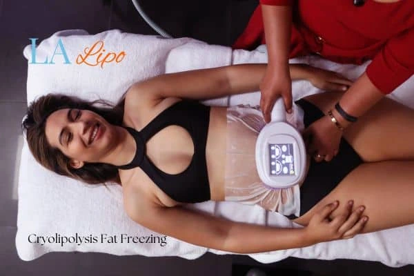 woman getting cryolipolysis Leicestershire