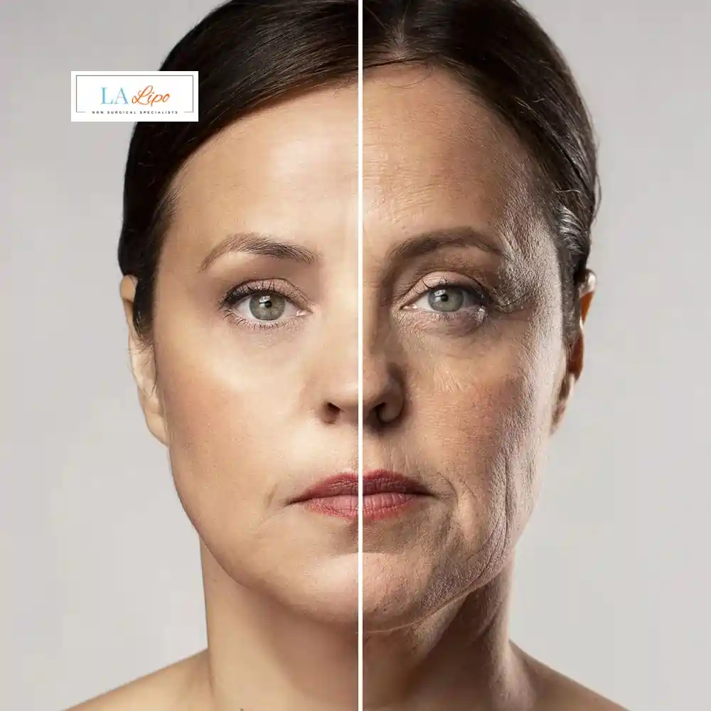How Can You Tell If Non-Surgical Skin Tightening Is Right for You Leicestershire?