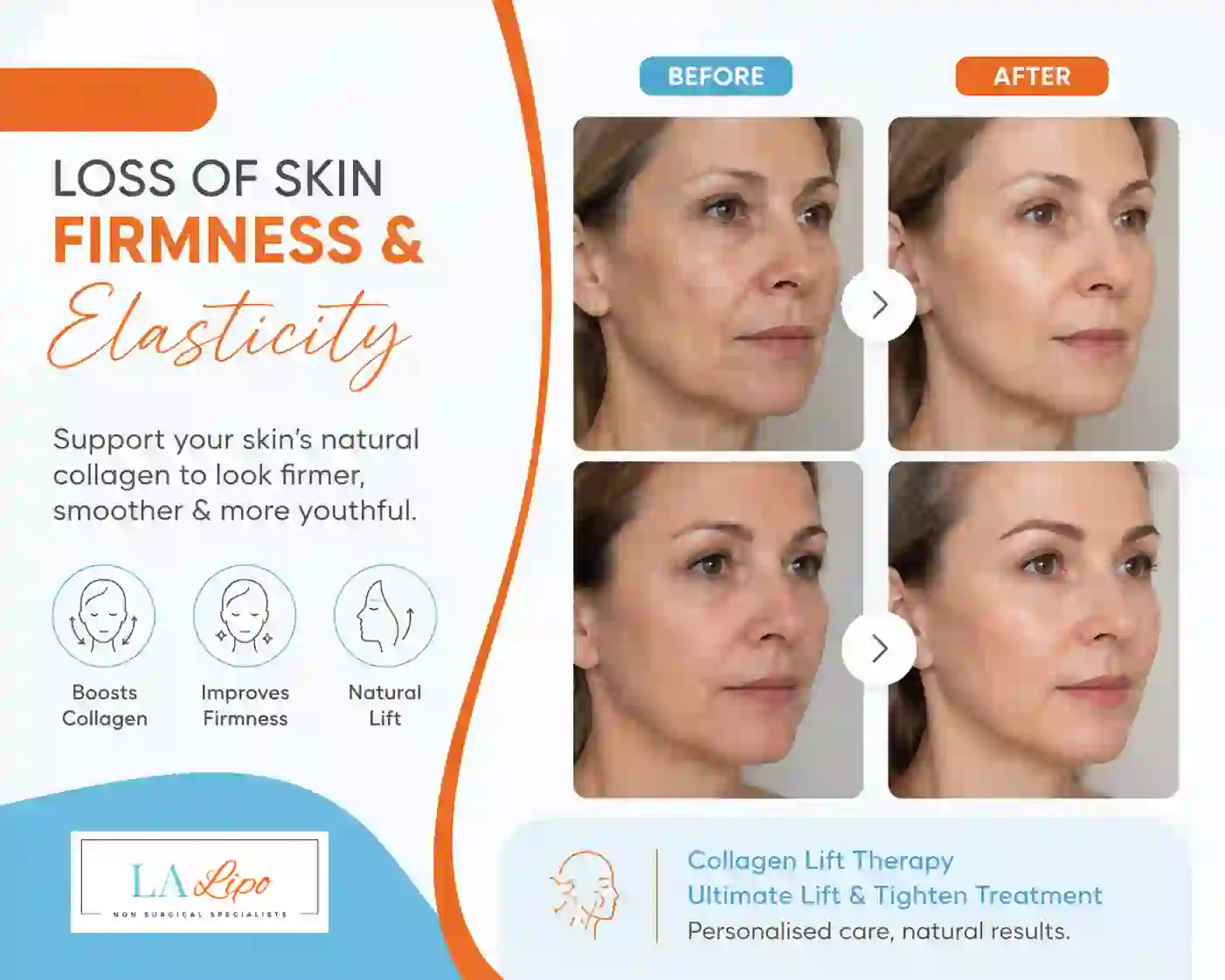 Sign #7: Loss of Skin Firmness and Elasticity Leicestershire