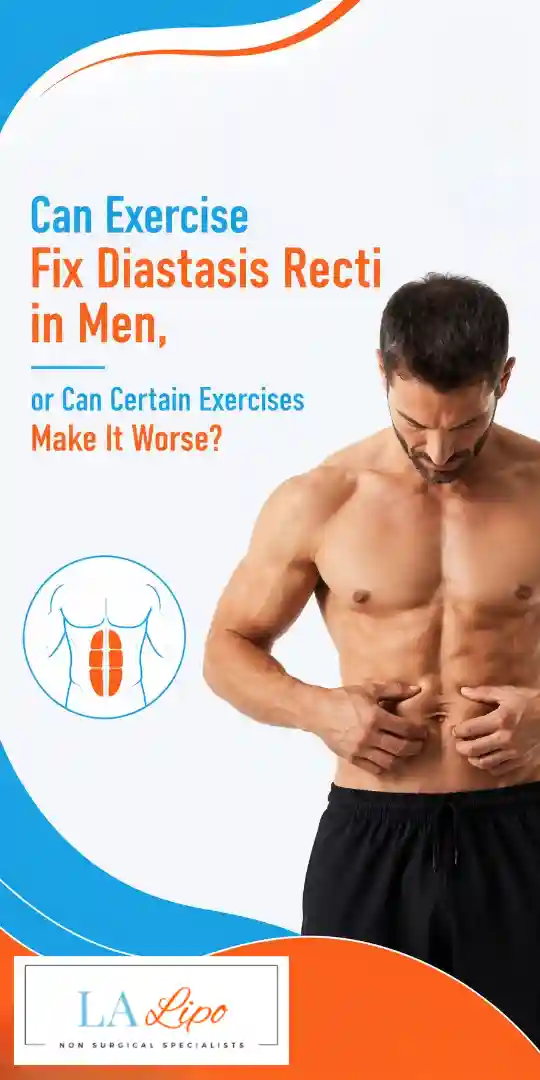 Can Exercise Fix Diastasis Recti in Men, or Can Certain Exercises Make It Worse Leicestershire?